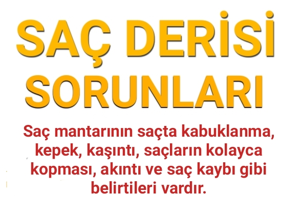 Saç Derisinde Beyaz Tortu Nasıl Geçer?