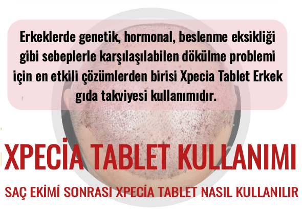  Xpecia Tablet Şok Dökülme Sonrası Kullanımı