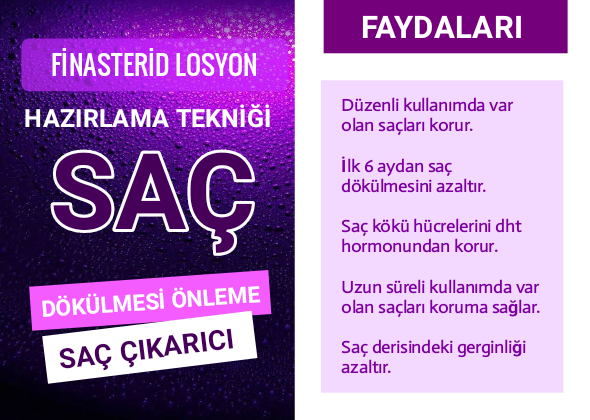 Finasterid Losyon Kullananlar Yorumları