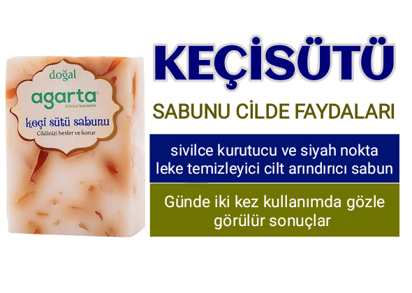 Keçi Sütü Sabunu Cilde Faydaları Nelerdir?